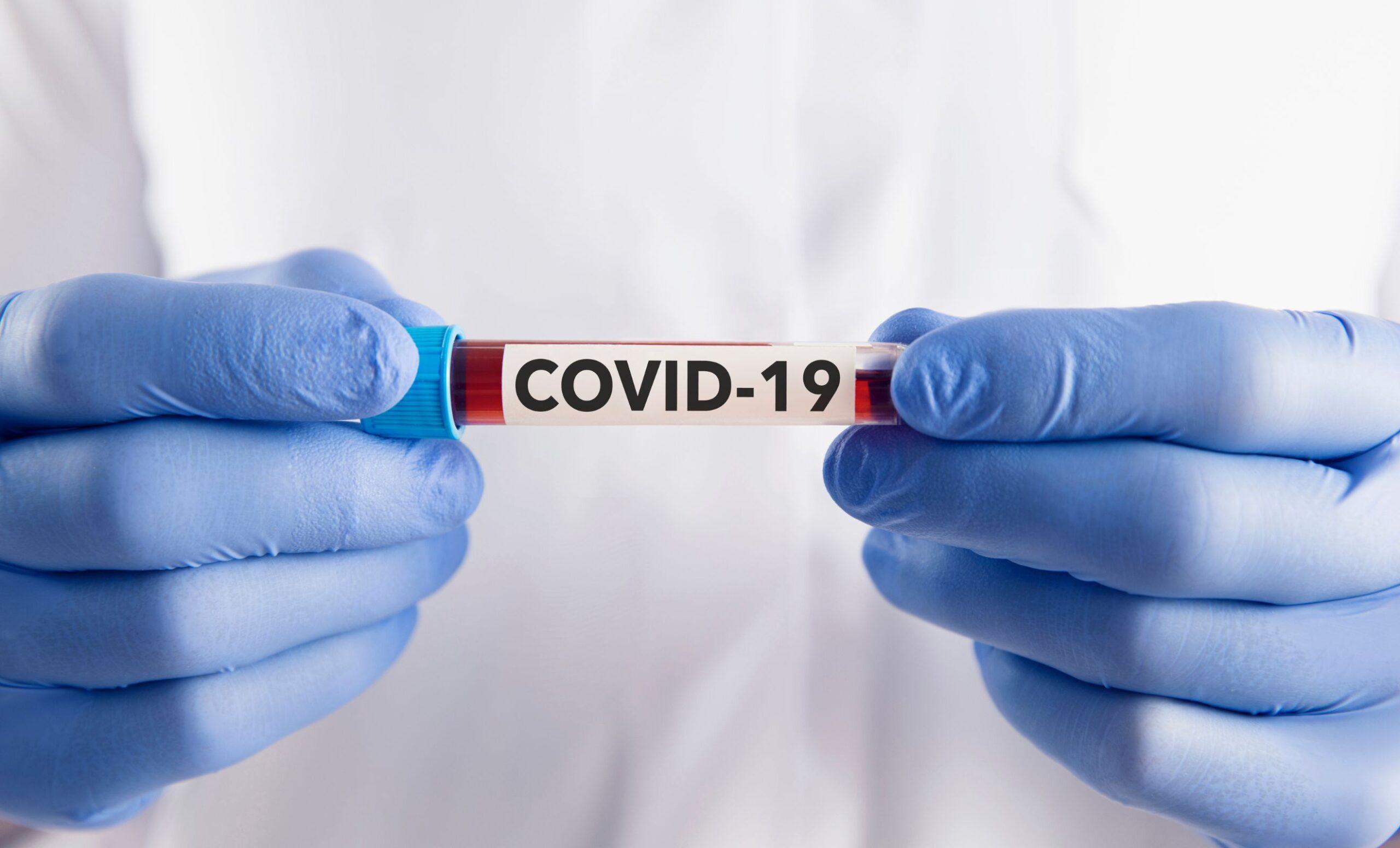 Kojim se redoslijedom pojavljuju simptomi COVID-a ove jeseni?